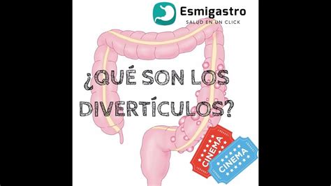 Diverticulos Youtube