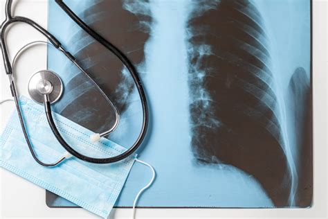 Não é Possível Reverter Um Quadro De Enfisema Pulmonar Dra Thais Leibel