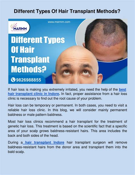 PPT - Different Types Of Hair Transplant Methods PowerPoint ...