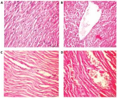 Histological Analysis Of Haematoxylin And Eosin Stained Rat Heart