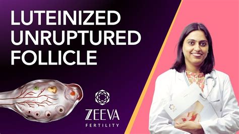 Luteinized Unruptured Follicle All About It Dr Shweta Goswami YouTube