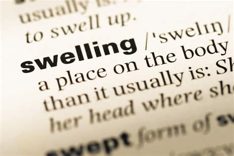 What Swelling Might Be Telling You | Overland Park, KS