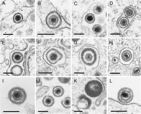 Morphology Of Virus Particles Virions In The Perinuclear Cisterna