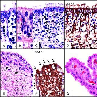 Normal Ependymal Cell Differentiation A Radial Glia Cell Exhibiting