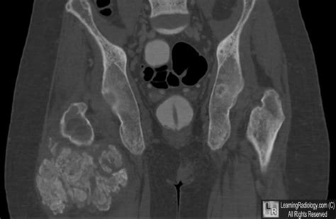 LearningRadiology MSK Image Gallery