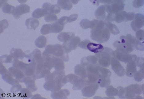 Plasmodium vivax 3 05.jpg