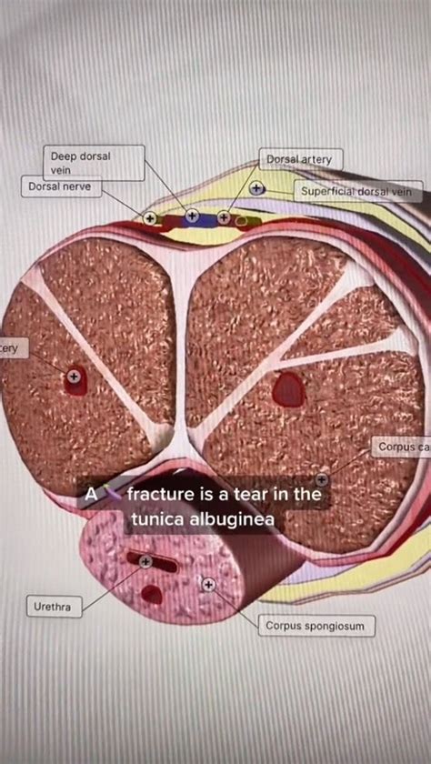 TikTok Doctor Reveals Which Sex Position Is Most Dangerous