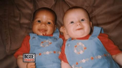 Lucy And Maria The Biracial Twin Sisters With Rare Black And White Skin