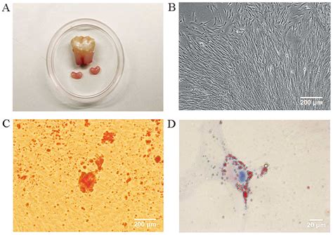 Proliferation And Odontogenic Differentiation Of Bmp Genetransfected