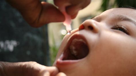 Us Doctor Issues Warning Of Many Undiagnosed Polio Cases Bbc News