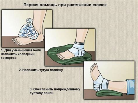 Лечение растяжения связок стопы: первая помощь, что делать дома, мази