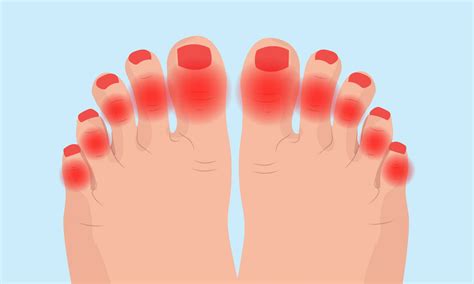 Arthritis in Your Feet: Causes, Symptoms, and Treatment | DeNiel Foot ...