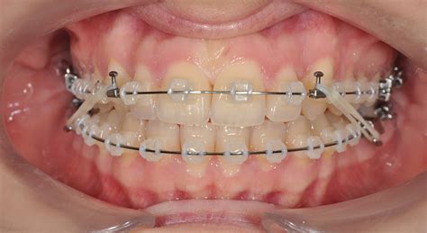 M Ster T Tulo Propio En Ortodoncia Y Ortopedia Dentofacial Tech Espa A