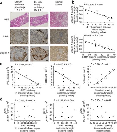 Immunostaining For Glomerular Sirt Or Claudin In Human Renal Biopsy