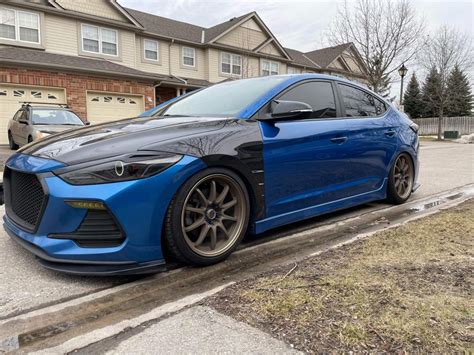 Elantra Sport Non Sport Carbon Fiber Fenders Socal Garage