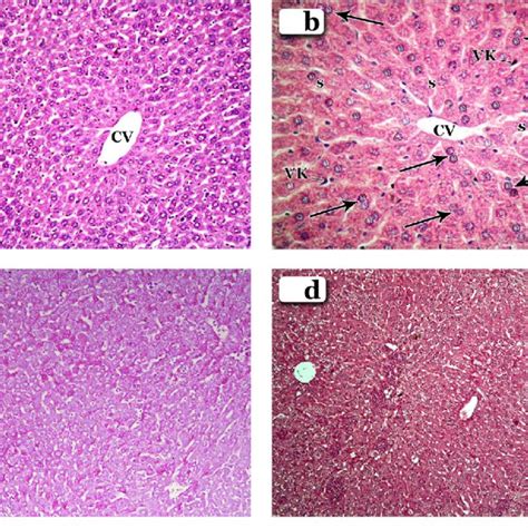 Photomicrographs Of Sections In The Mice Livers Of The Control Group