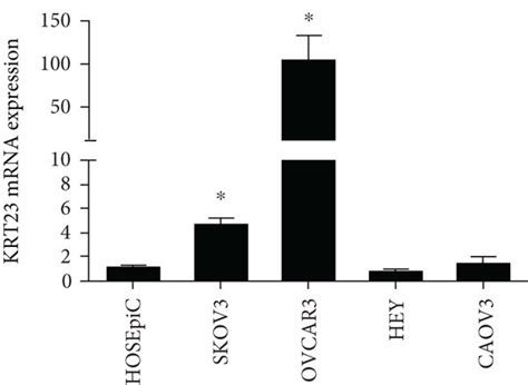 The Expression Of Keratin Krt In Ovarian Cancer Oc Tissues And