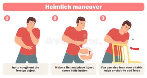 Heimlich Maneuver Stock Illustrations 117 Heimlich Maneuver Stock Illustrations Vectors