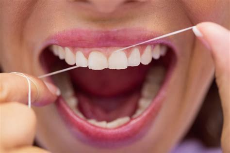 Reasons Behind The Importance Of Flossing Dentist In Airdrie