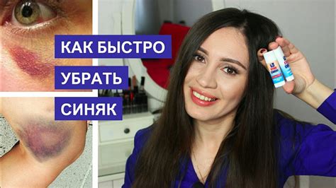 КАК БЫСТРО УБРАТЬ СИНЯК? ПРОВЕРЕННЫЙ СПОСОБ! - YouTube
