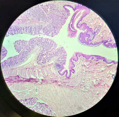 Rectal Anal Junction X Diagram Quizlet