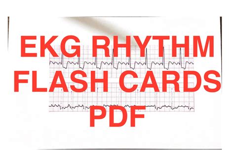 ECG Rhythm Note Cards In A PDF Format Etsy Worksheets Library