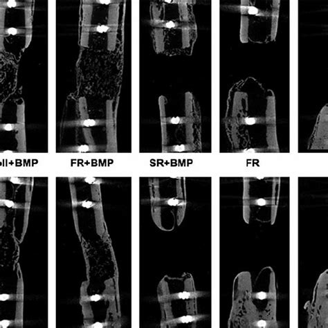 Representative MicroCT Images Of New Bone Formation All Images Are