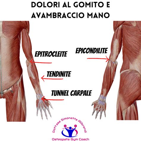 Applicando Arresto Multiuso Tendinite Epicondilite Udibile Insondabile