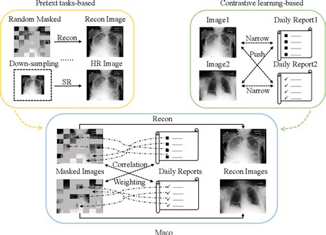 Enhancing Representation In Radiography Reports Foundation Model A Granular Alignment Algorithm