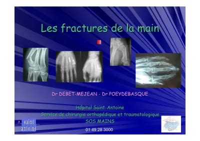 Les Fractures De La Main Les Fractures De La Main