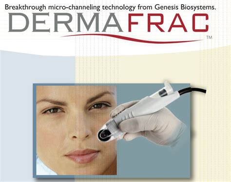 Aparat Genesis Biosystems Dermafrac C Micro Needlling Skin Rejuvenation