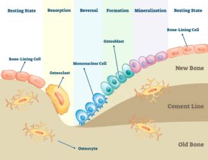 Bone Remodeling Process: Bone Resorption | Biogennix