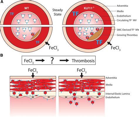 KLF11 (Krüppel-Like Factor 11) Modulates Arterial Thrombosis ... 