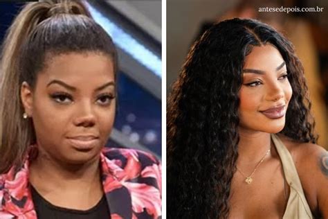 Ludmilla Antes E Depois Da Cantora Ap S Cirurgias