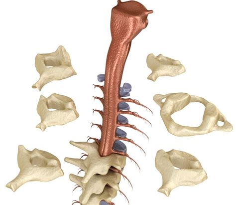 Spinal Injuries Shepherd Healthcare Group