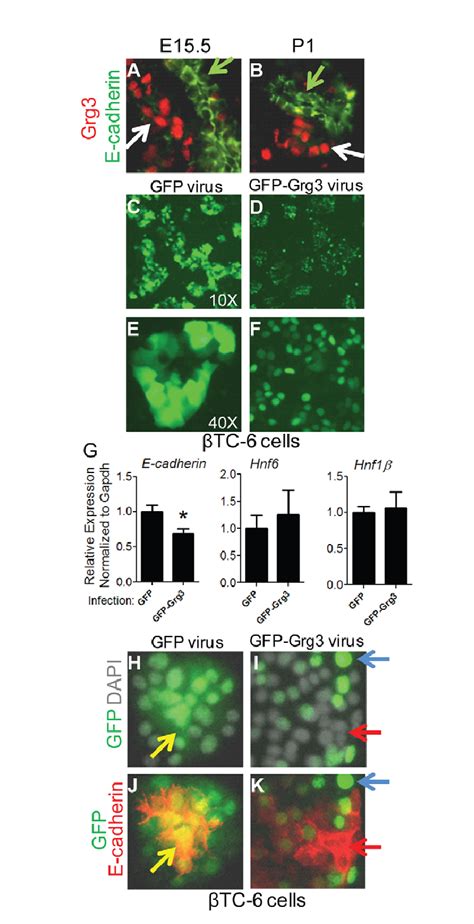 Grg Suppresses E Cadherin Expression A B Grg Is Highly Expressed