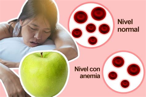 Alimentación Para Combatir La Anemia Nuevas Evas