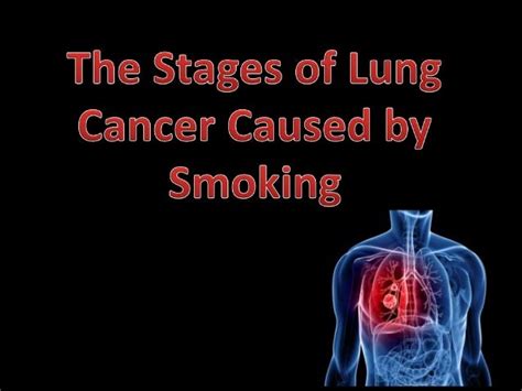 The Stages Of Lung Cancer Caused By Smoking