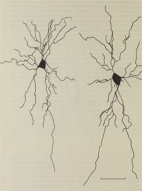 Figure 2 From The Basal Dendrites Of Meynert Cells In The Striate