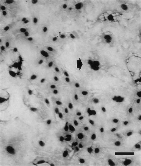 Ovine Mammary Gland Epithelial Cell Omec Culture From Maedi Visna