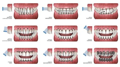 Santé bucco dentaire la meilleure façon de se brosser les dents