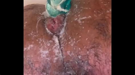 Prolapse Anal Fucking By Tony Tunnels Xxx Mobile Porno Videos Movies IPornTV Net