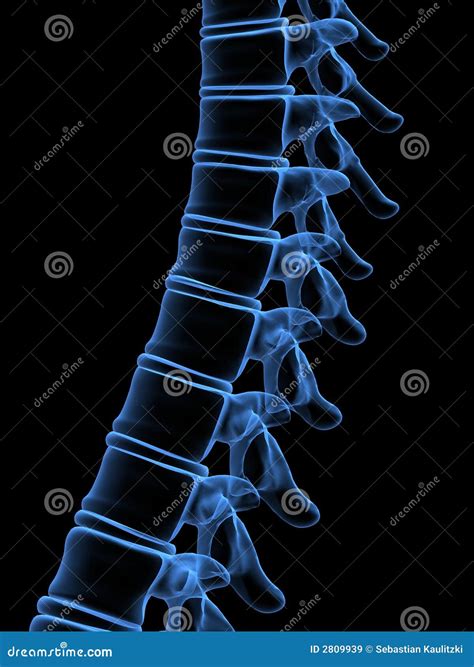 X-ray Human Spine Royalty Free Stock Images - Image: 2809939