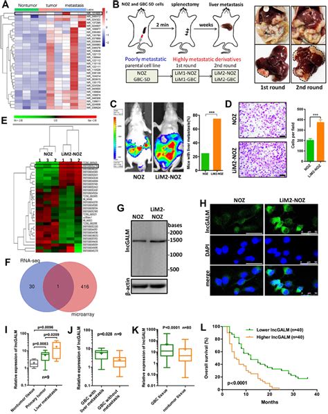 Upregulated LncGALM Was Found In GBC Liver Metastatic Tumors And