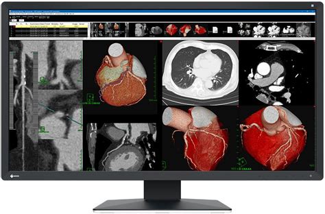 Eizo Radiforce Mx W Eizo Befundungsmonitore Raumklasse