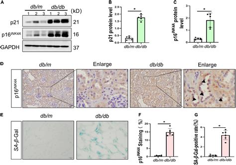 Frontiers Senescent Renal Tubular Epithelial Cells Activate