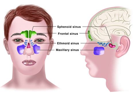 Chronic Sinusitis: Symptoms, Causes, Treatments and Home Remedies