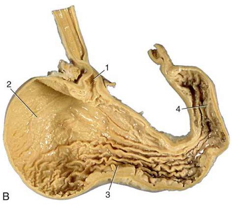 Dog stomach Diagram | Quizlet