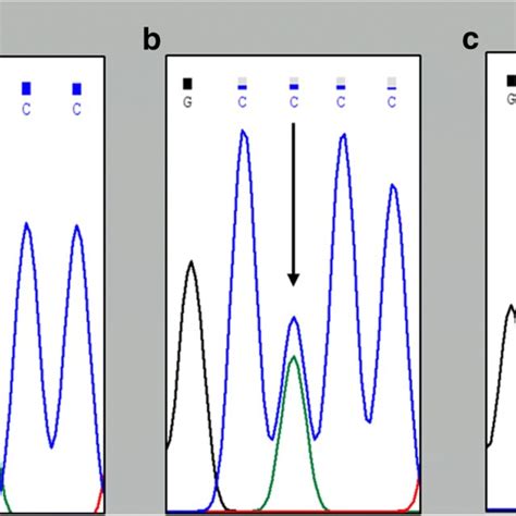 Partial Sequence Chromatograms Of Bsmi Polymorphism From Study