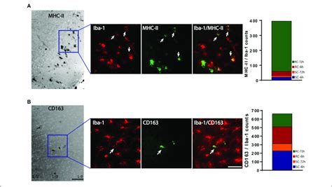 M And M Marker Expression By Activated Microglia In The